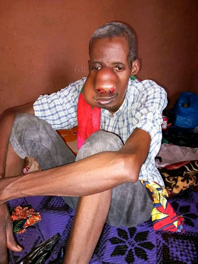 🇸🇳 Appel urgence Mohamed et malade