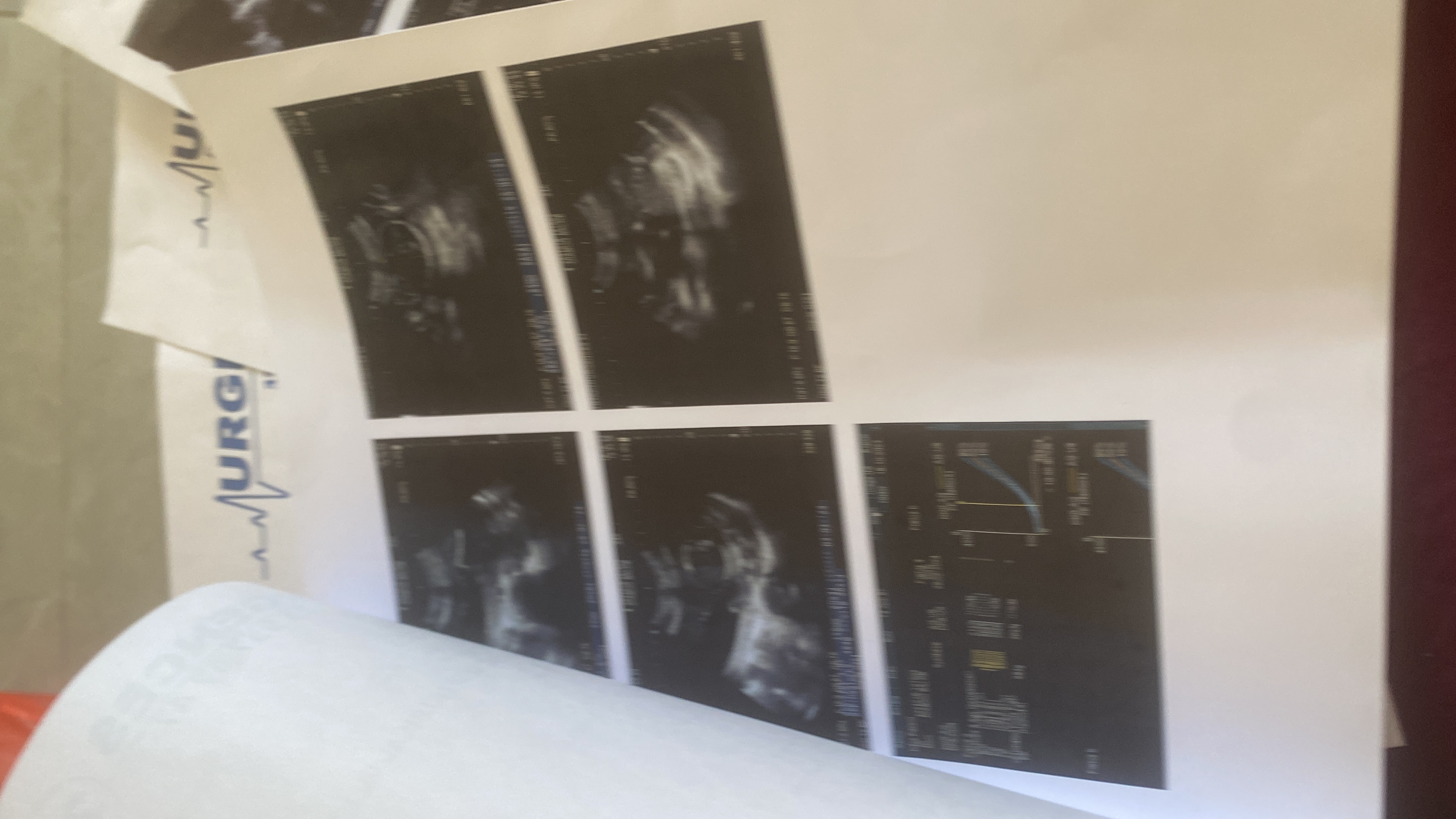 Aider moi à garder ma grossesse jusqu’au terme j’ai un enfant et je suis enceinte d’un autre leur père m’a abandonné et je veux pas avorté cette enfant